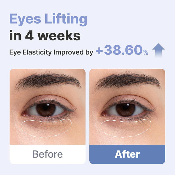 Arocell Eye Cream Results