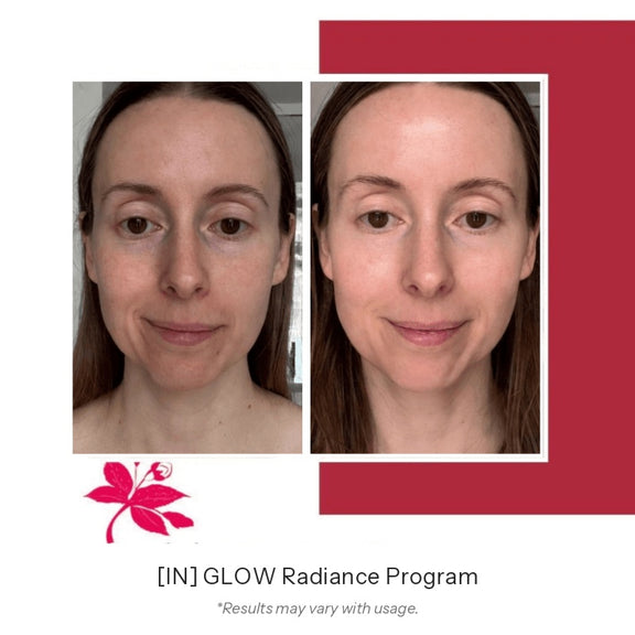 FLOREVE IN GLOW Radiance Before After