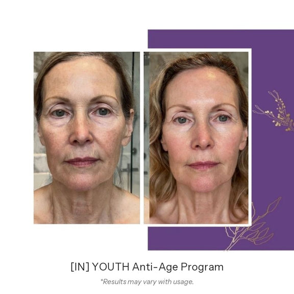 FLOREVE IN YOUTH Anti-Aging Before After