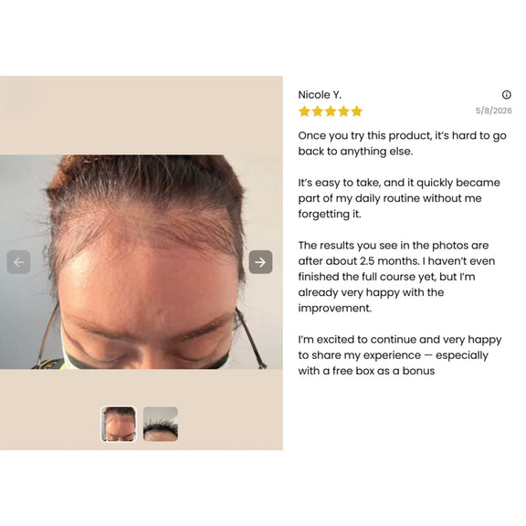 FLORÊVE [IN] YOUTH Anti-Hair Loss Cure client review
