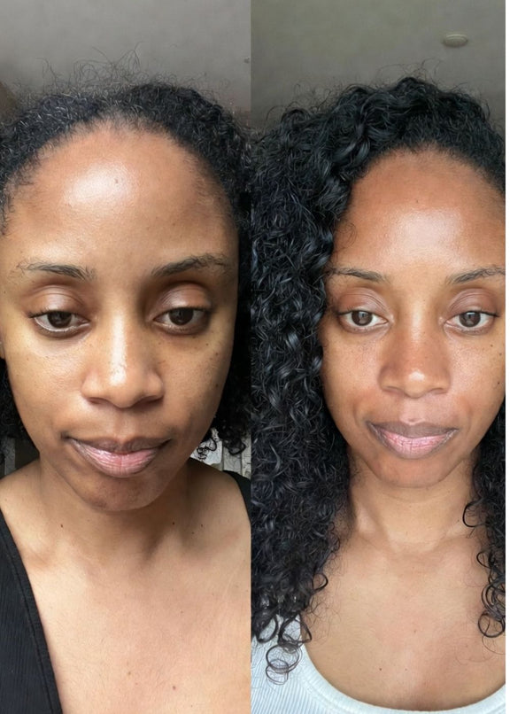Floreve Anti Hair Loss Before and After
