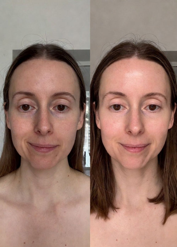 Floreve Glow Before and After